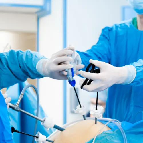 General And Laparoscopic Surgery